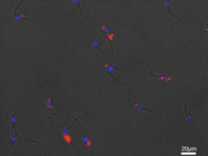 Microglia fagocitando restos de mielina marcada.
