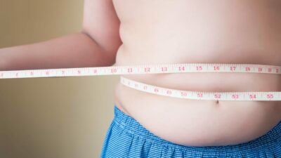 niño sobrepeso gordura obesidad infantil