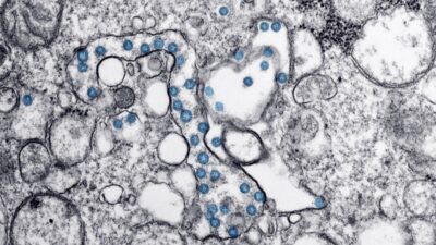 Partículas del virus SARS-CoV-2, coloreadas en azul, en una imagen de microscopio de electrones. / CDC