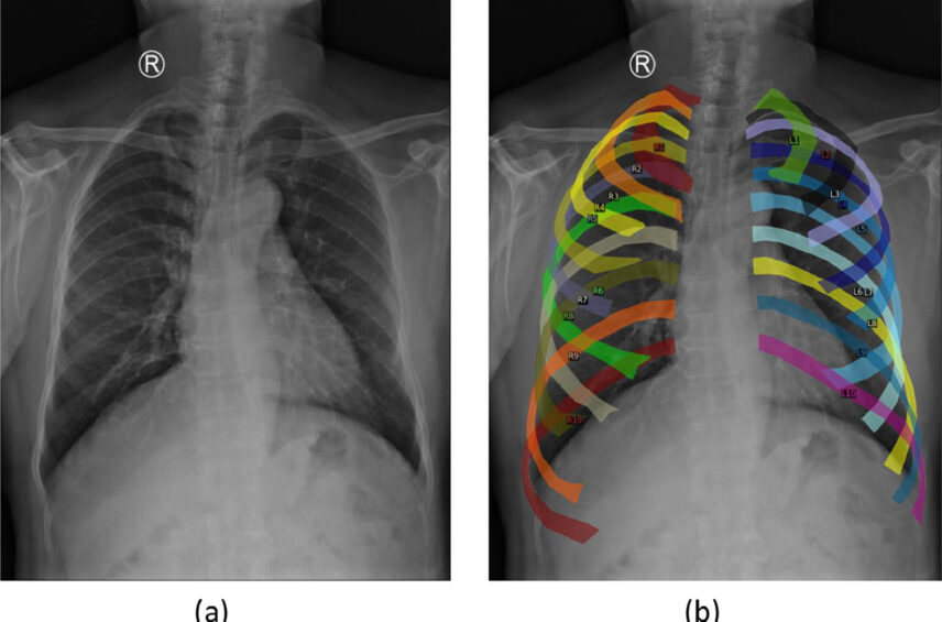 Fotografía ilustrativa del artículo