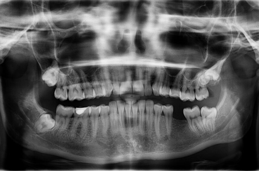 Fotografía ilustrativa del artículo