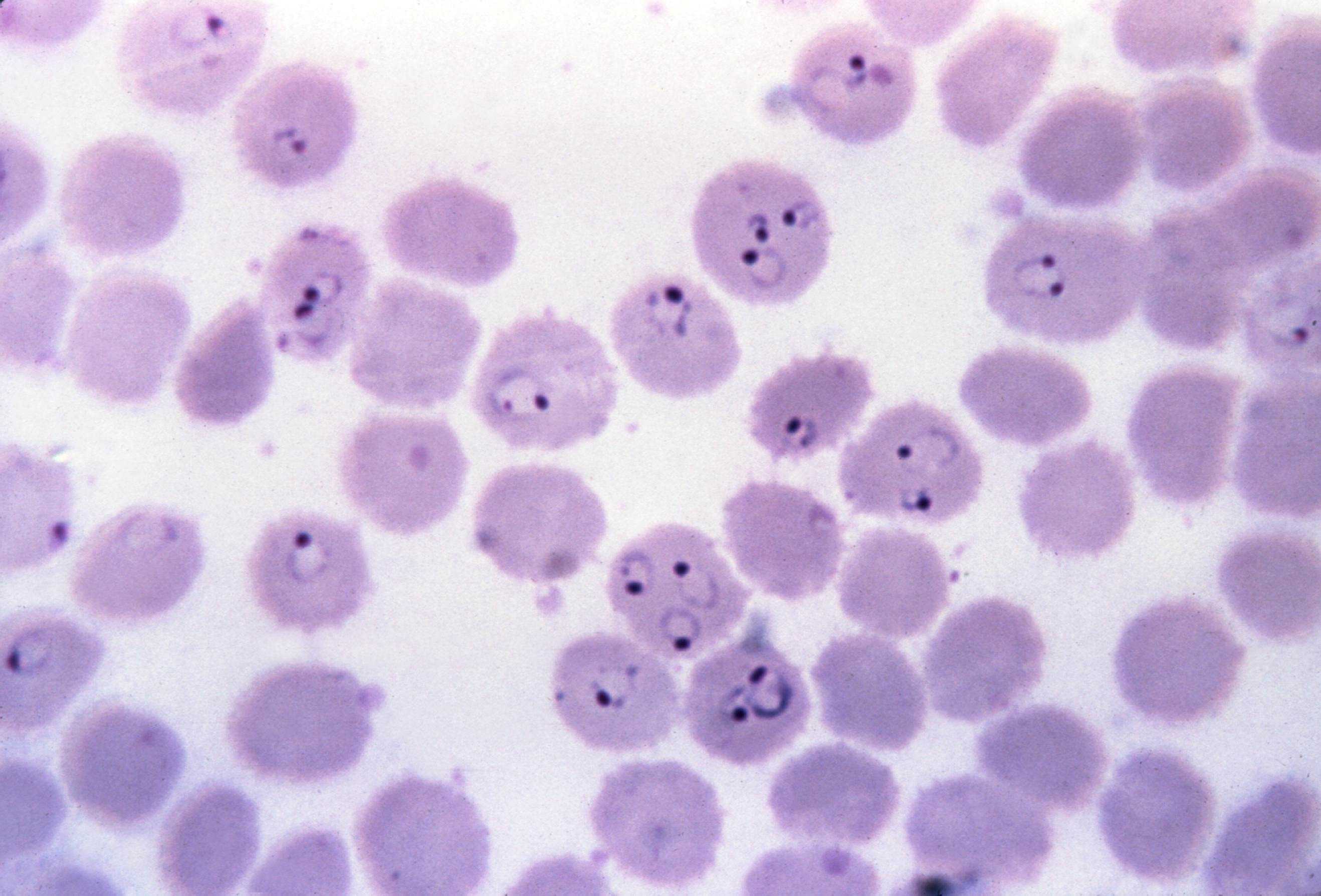 Малярия клетки. Малярийный плазмодий микрофотография. Малярийный плазмодий фальципарум. Малярийный плазмодий микроскопия. Малярийный плазмодий микроскоп.