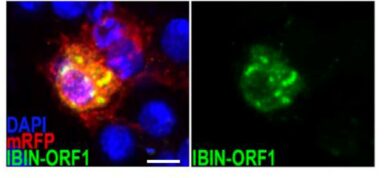 Expresión de un gen corto visualizada con el gen chivato verde fluorescente, en este caso podemos ver donde IBIN está activo que tiene una función en el sistema inmunitario. / Nature Communications