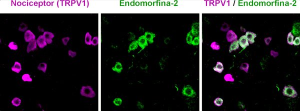 Marcaje inmunohistoquímico de los nociceptores, las neuronas sensoriales periféricas que median el dolor (marcadas con TRPV1, en magenta), y el marcaje del opioide endomorfina-2 (en verde). Nótese en la fusión de ambas imágenes que gran parte de las neuronas TRPV1 producen el opioide endomorfina-2.